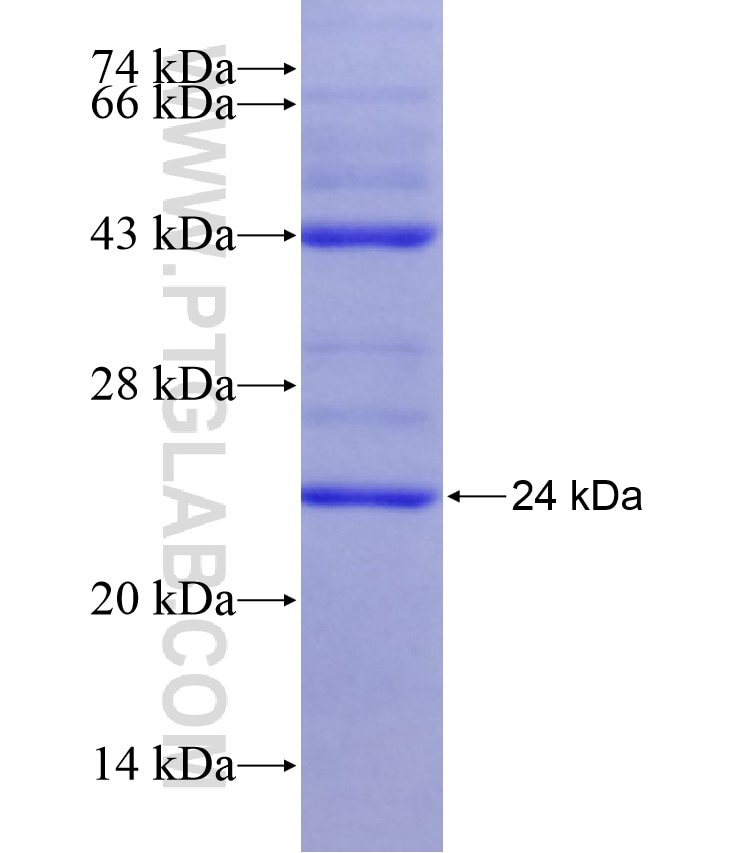 CA15-3,MUC1 fusion protein Ag17660 SDS-PAGE
