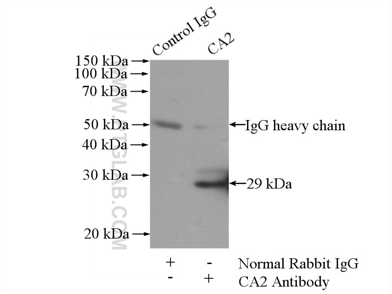 Immunoprecipitation (IP) experiment of mouse kidney tissue using CA2 Polyclonal antibody (16961-1-AP)