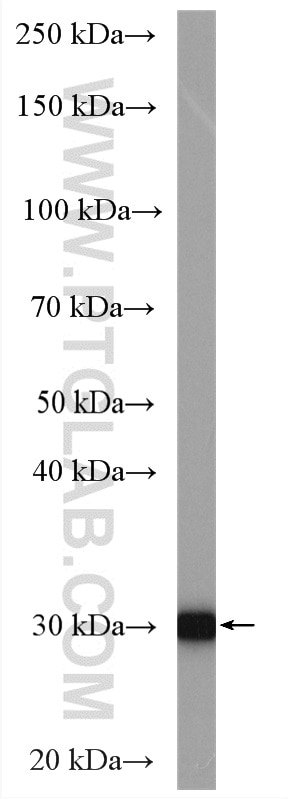 Western Blot (WB) analysis of mouse colon tissue using CA2 Polyclonal antibody (16961-1-AP)