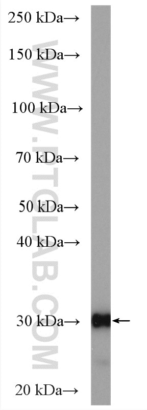 Western Blot (WB) analysis of mouse kidney tissue using CA2 Polyclonal antibody (16961-1-AP)