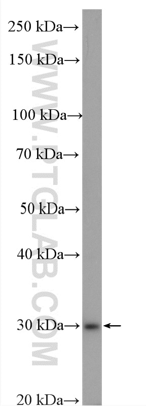 Western Blot (WB) analysis of U2OS cells using CA2 Polyclonal antibody (16961-1-AP)