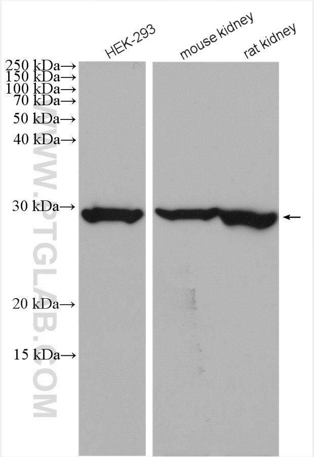 Western Blot (WB) analysis of various lysates using CA2 Polyclonal antibody (16961-1-AP)