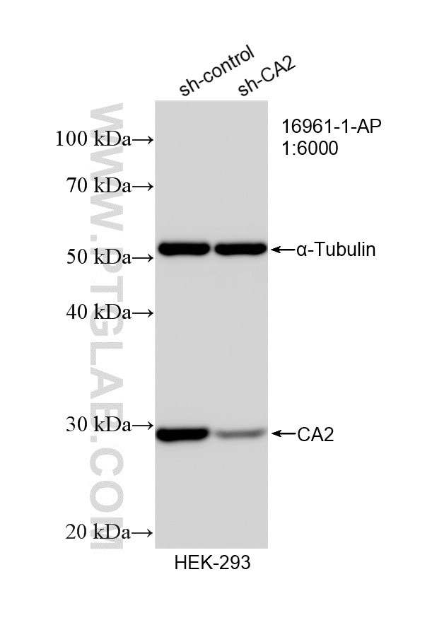 Western Blot (WB) analysis of HEK-293 cells using CA2 Polyclonal antibody (16961-1-AP)