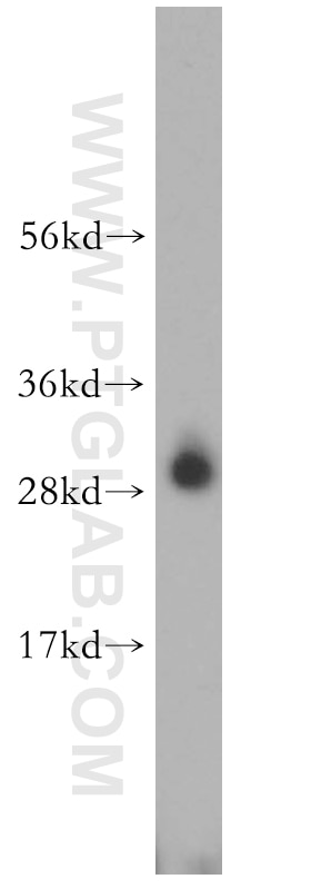 Western Blot (WB) analysis of rat kidney tissue using CA2 Polyclonal antibody (16961-1-AP)