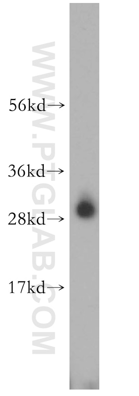 WB analysis of rat kidney using 16961-1-AP