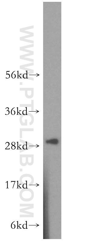 Western Blot (WB) analysis of human stomach tissue using CA2 Polyclonal antibody (16961-1-AP)