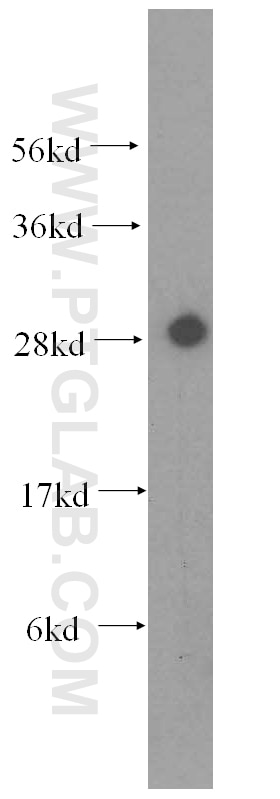 Western Blot (WB) analysis of mouse ovary tissue using CA2 Polyclonal antibody (16961-1-AP)