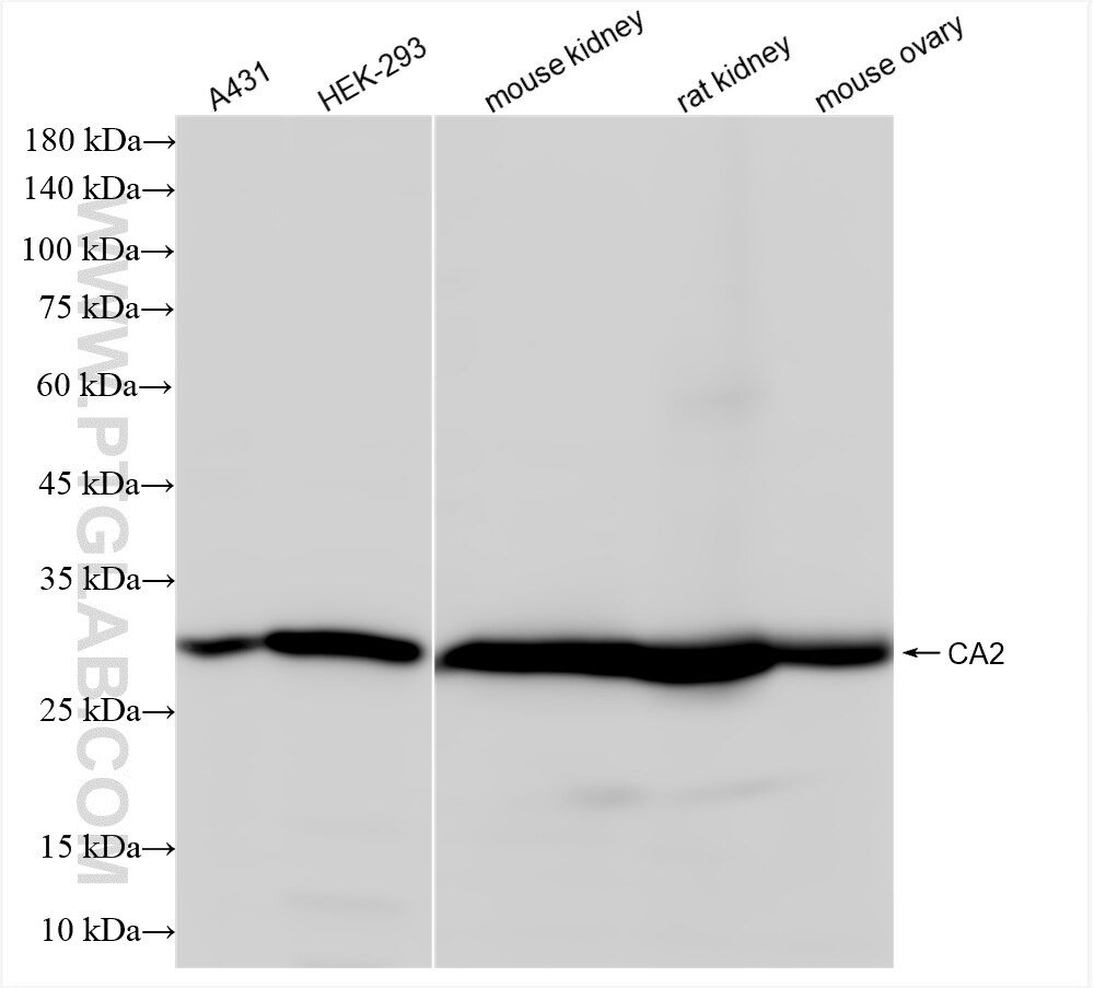 Western Blot (WB) analysis of various lysates using CA2 Recombinant antibody (84954-4-RR)