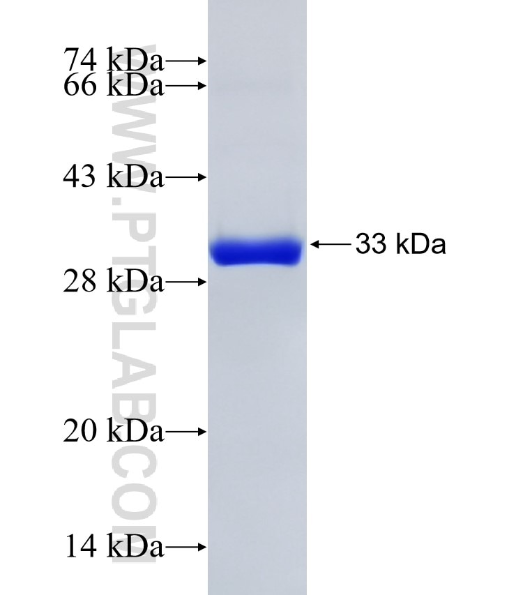 CA2 fusion protein Ag10676 SDS-PAGE