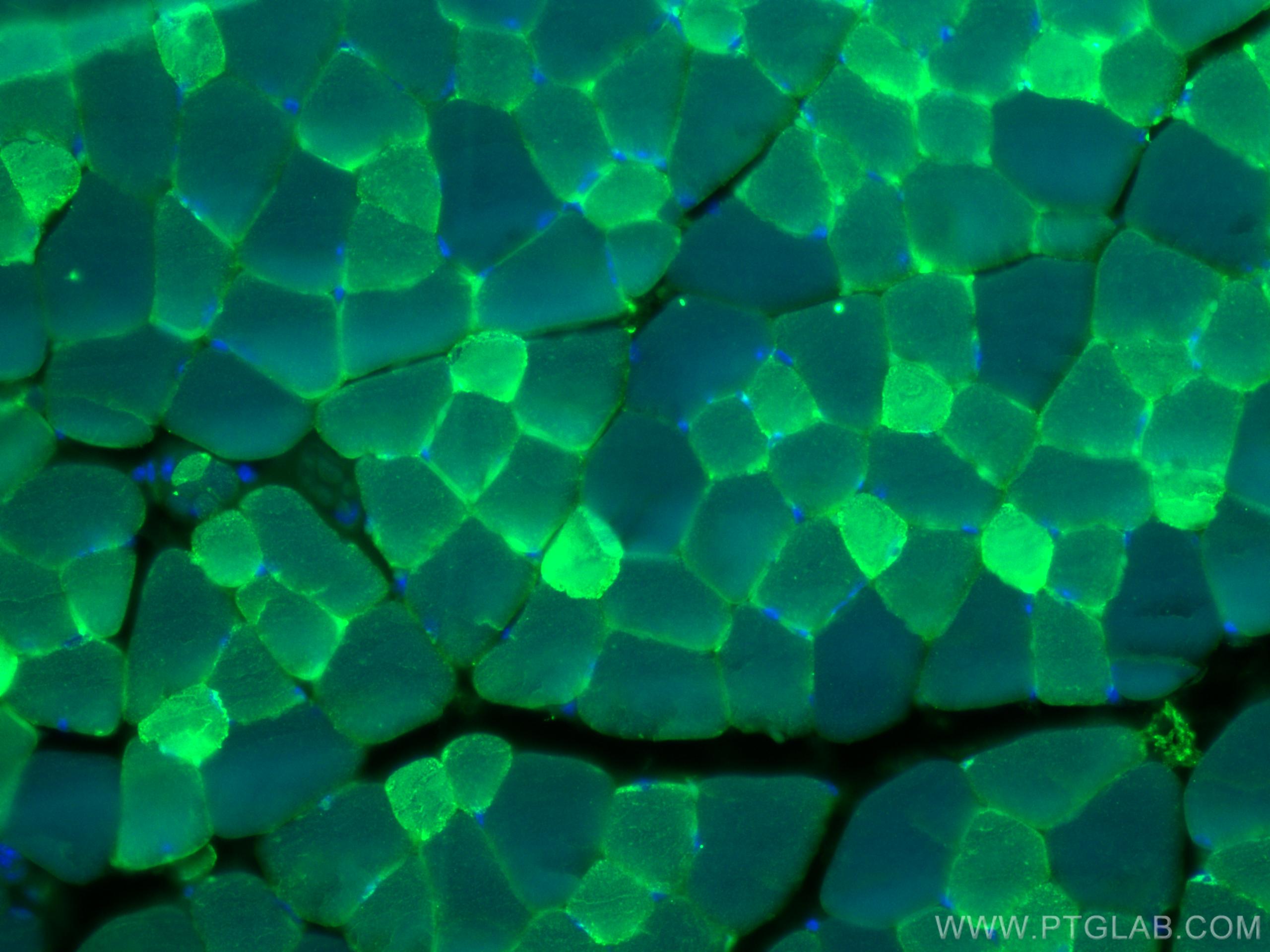 Immunofluorescence (IF) / fluorescent staining of mouse skeletal muscle tissue using CA3 Polyclonal antibody (15197-1-AP)