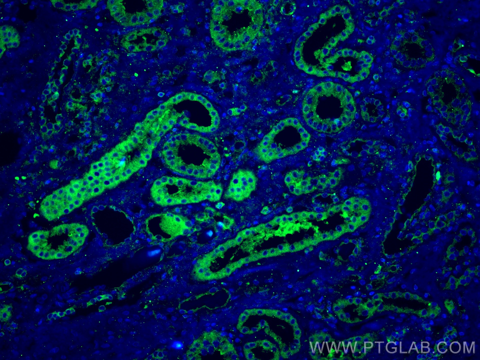 Immunofluorescence (IF) / fluorescent staining of human kidney tissue using CA3 Polyclonal antibody (15197-1-AP)