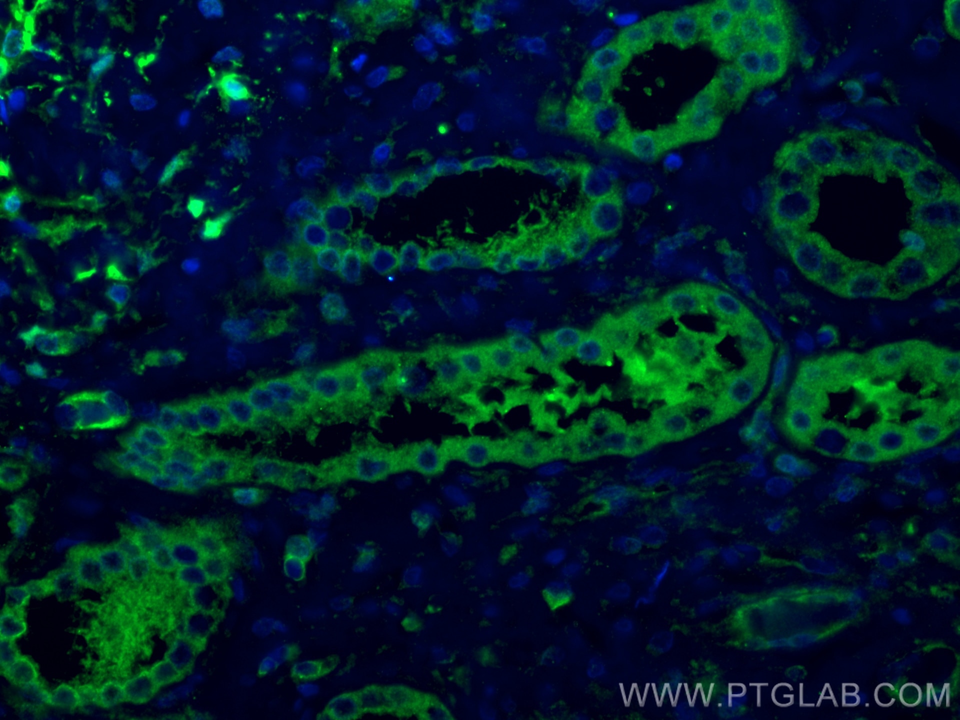 Immunofluorescence (IF) / fluorescent staining of human kidney tissue using CA3 Polyclonal antibody (15197-1-AP)