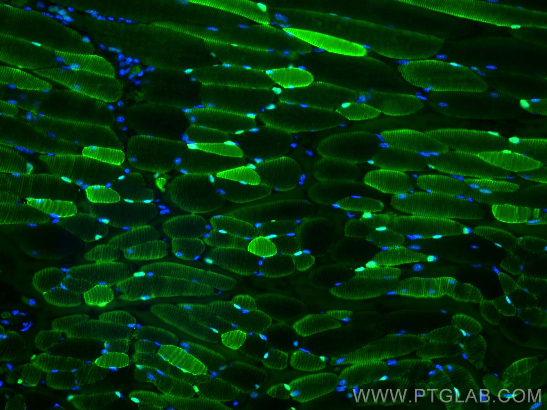 Immunofluorescence (IF) / fluorescent staining of mouse skeletal muscle tissue using CA3 Polyclonal antibody (15197-1-AP)