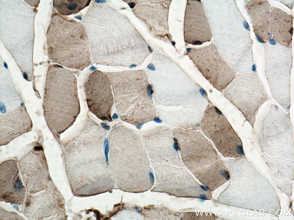 Immunohistochemistry (IHC) staining of mouse skeletal muscle tissue using CA3 Polyclonal antibody (15197-1-AP)