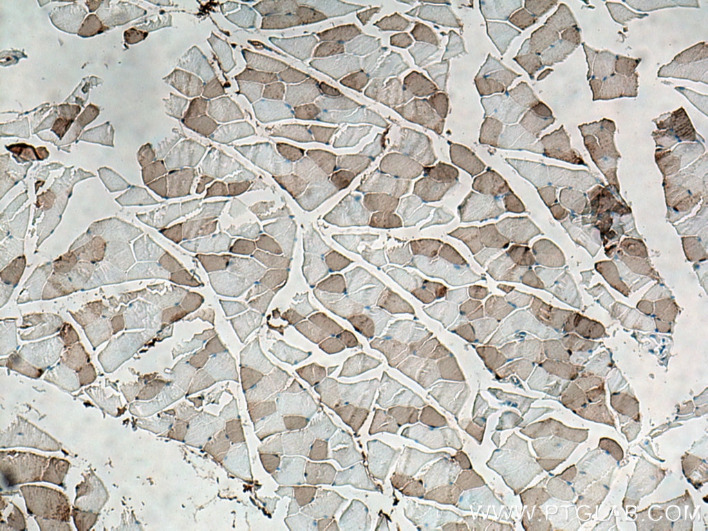 Immunohistochemistry (IHC) staining of mouse skeletal muscle tissue using CA3 Polyclonal antibody (15197-1-AP)
