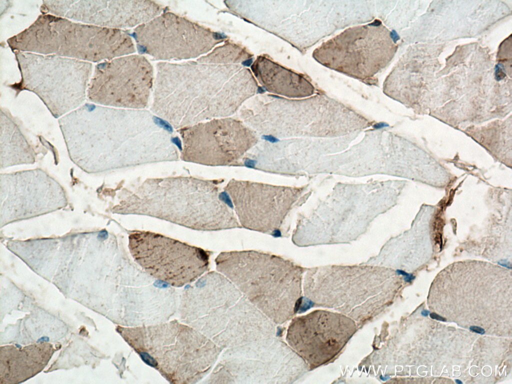 Immunohistochemistry (IHC) staining of mouse skeletal muscle tissue using CA3 Polyclonal antibody (15197-1-AP)