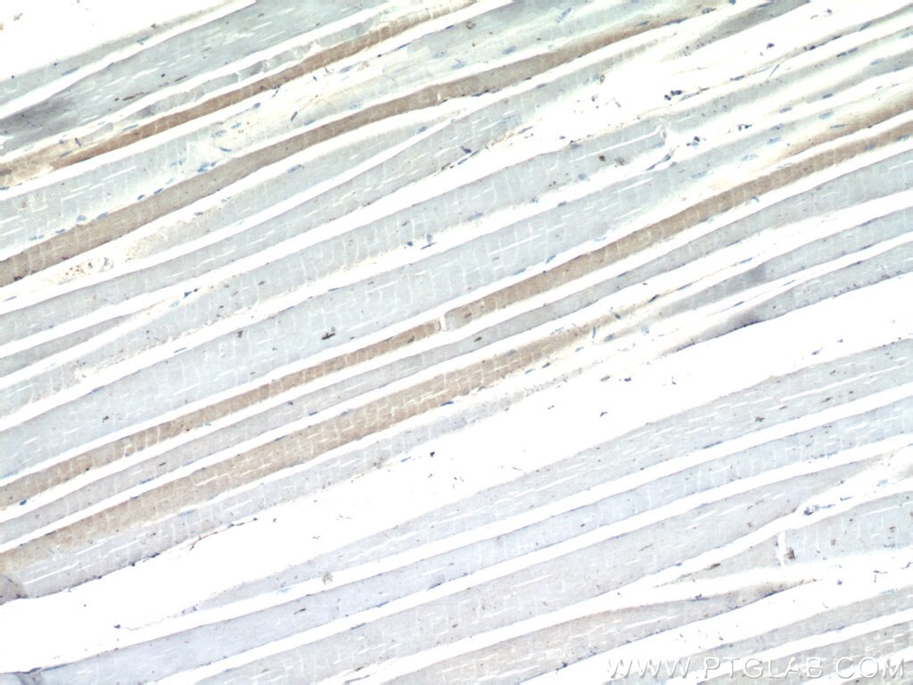 IHC staining of mouse skeletal muscle using 15197-1-AP