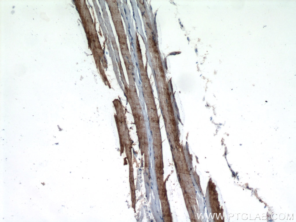 IHC staining of rat skeletal muscle using 15197-1-AP