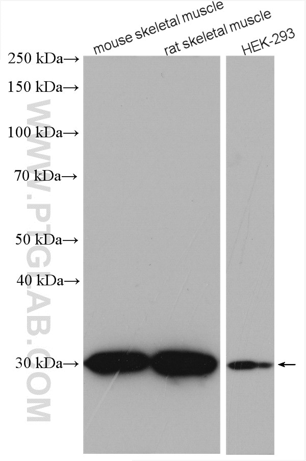 Western Blot (WB) analysis of various lysates using CA3 Polyclonal antibody (15197-1-AP)