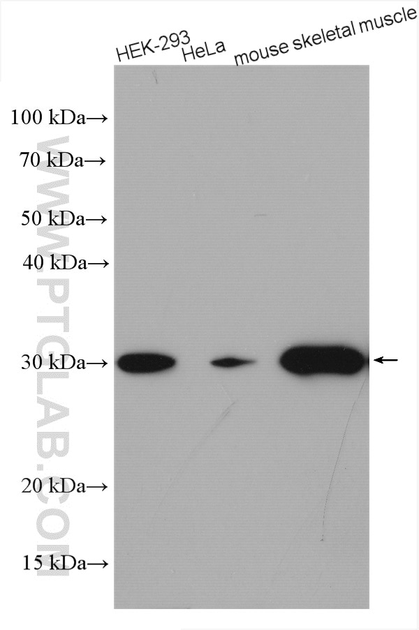 Western Blot (WB) analysis of various lysates using CA3 Polyclonal antibody (15197-1-AP)