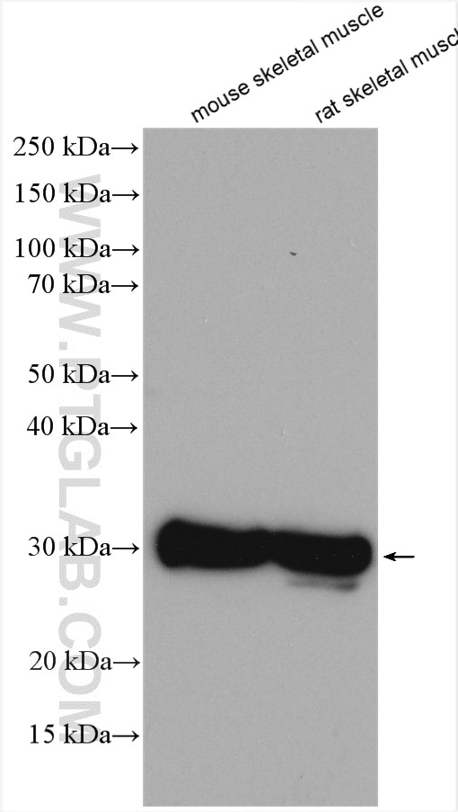 Western Blot (WB) analysis of various lysates using CA3 Polyclonal antibody (15197-1-AP)