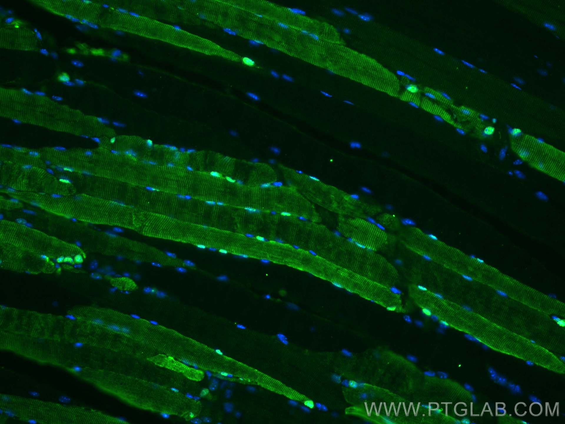 Immunofluorescence (IF) / fluorescent staining of mouse skeletal muscle tissue using CA3 Monoclonal antibody (66608-1-Ig)