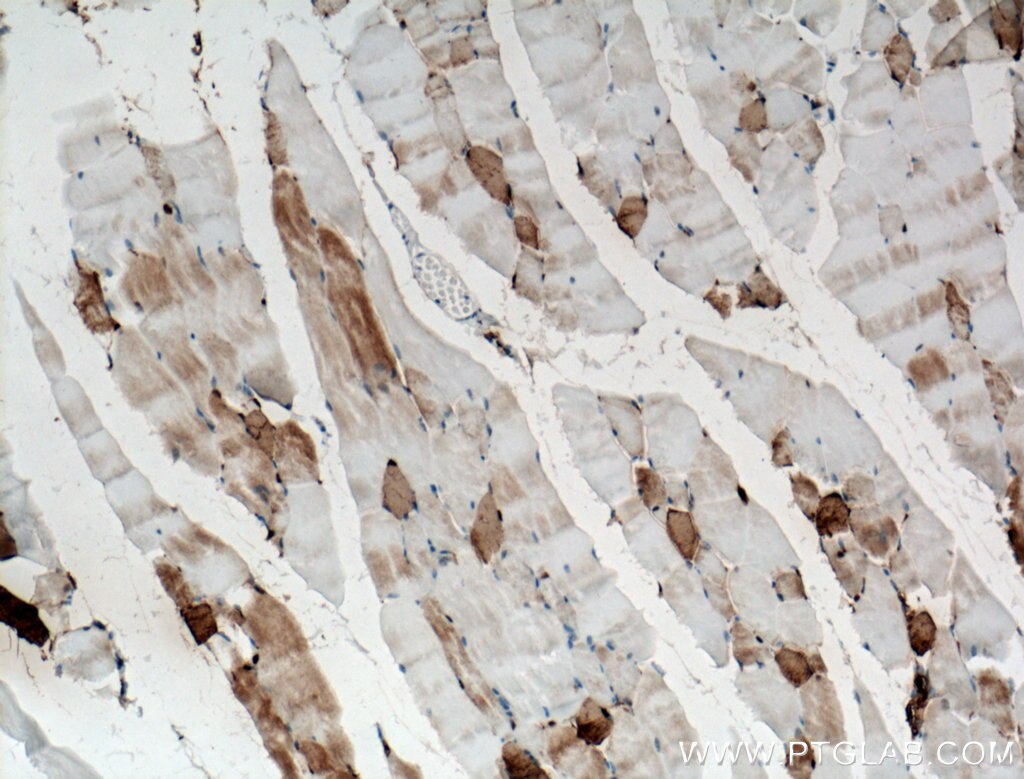 Immunohistochemistry (IHC) staining of mouse skeletal muscle tissue using CA3 Monoclonal antibody (66608-1-Ig)