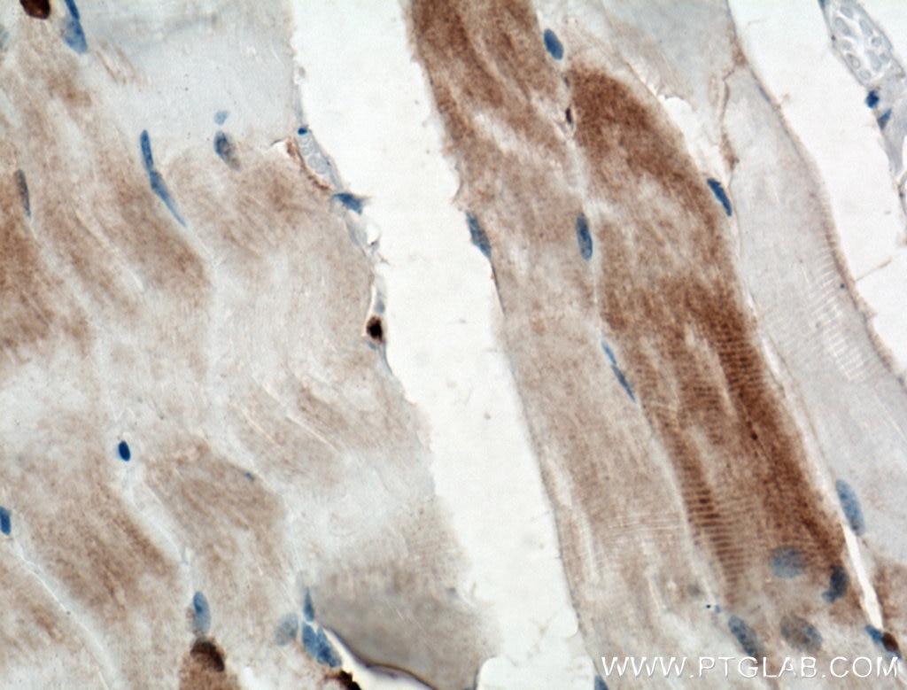 Immunohistochemistry (IHC) staining of mouse skeletal muscle tissue using CA3 Monoclonal antibody (66608-1-Ig)