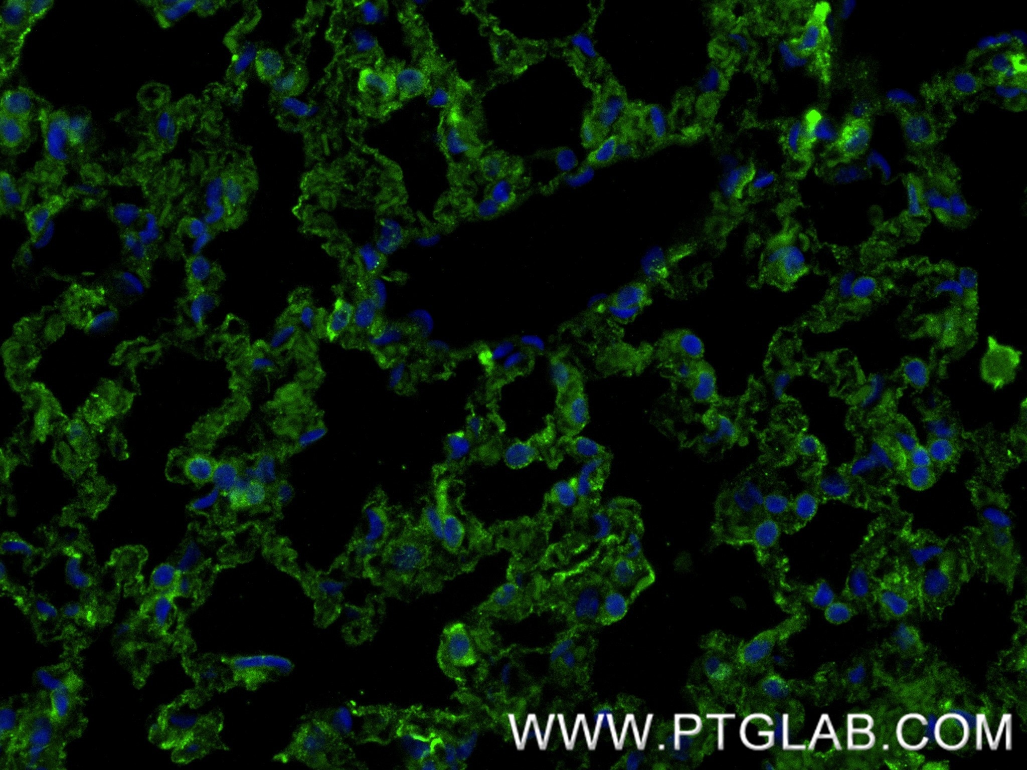 IF Staining of mouse lung using 85706-1-RR (same clone as 85706-1-PBS) Immunofluorescence (IF) / fluorescent staining of mouse lung tissue using Carbonic Anhydrase 4/CA4 Recombinant monoclonal an (85706-1-RR)
