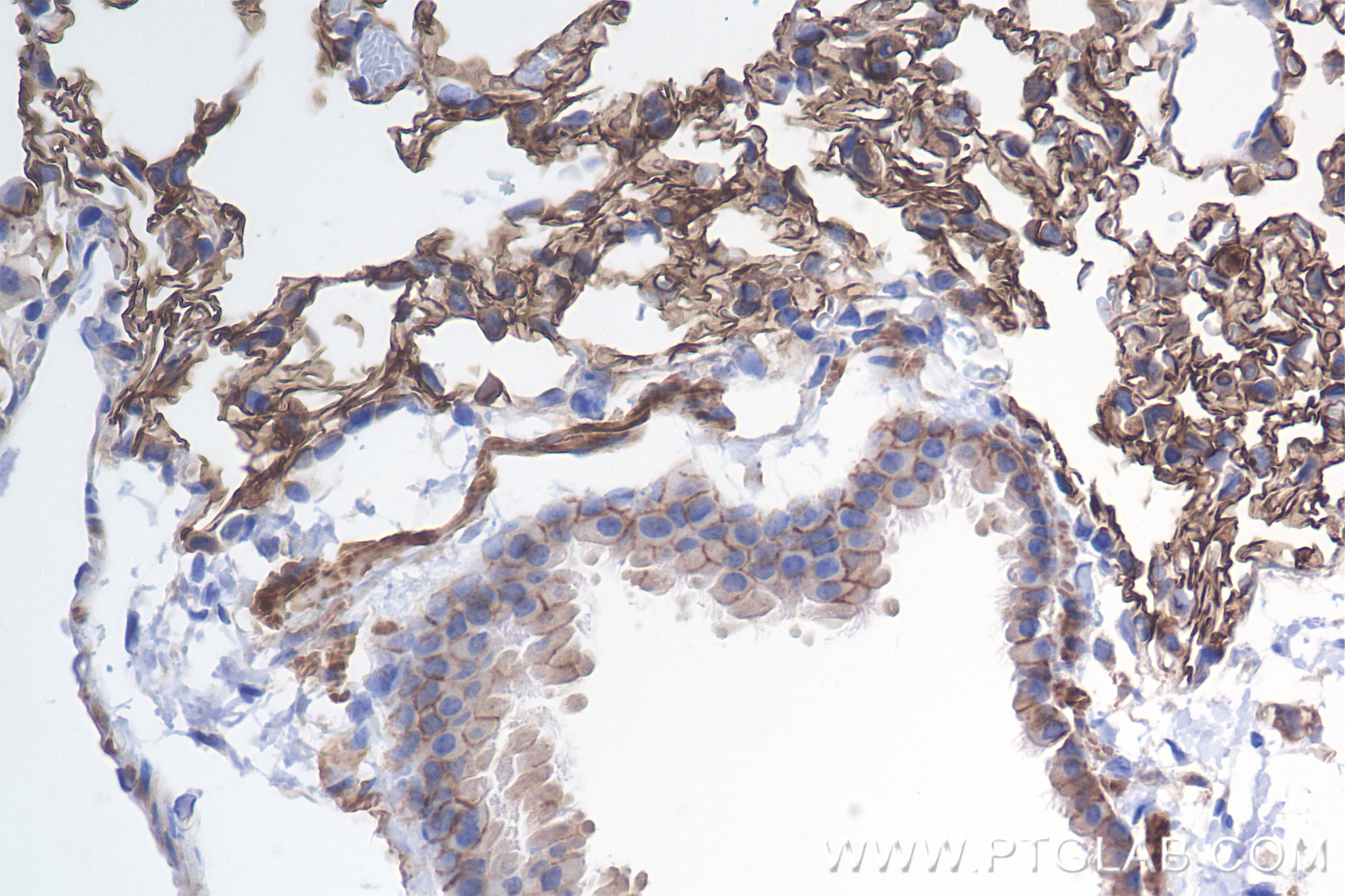 Immunohistochemistry (IHC) staining of mouse lung tissue using CA4 Recombinant antibody (85706-1-RR)