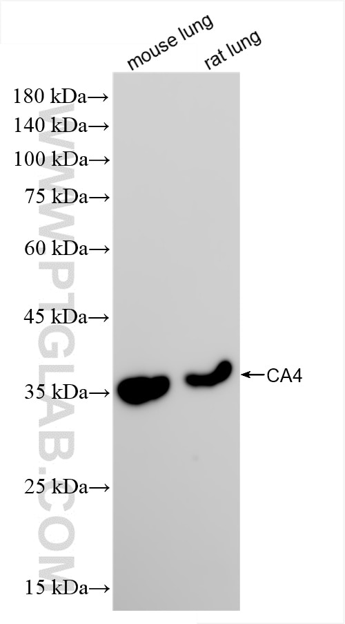 Western Blot (WB) analysis of various lysates using CA4 Recombinant antibody (85706-1-RR)