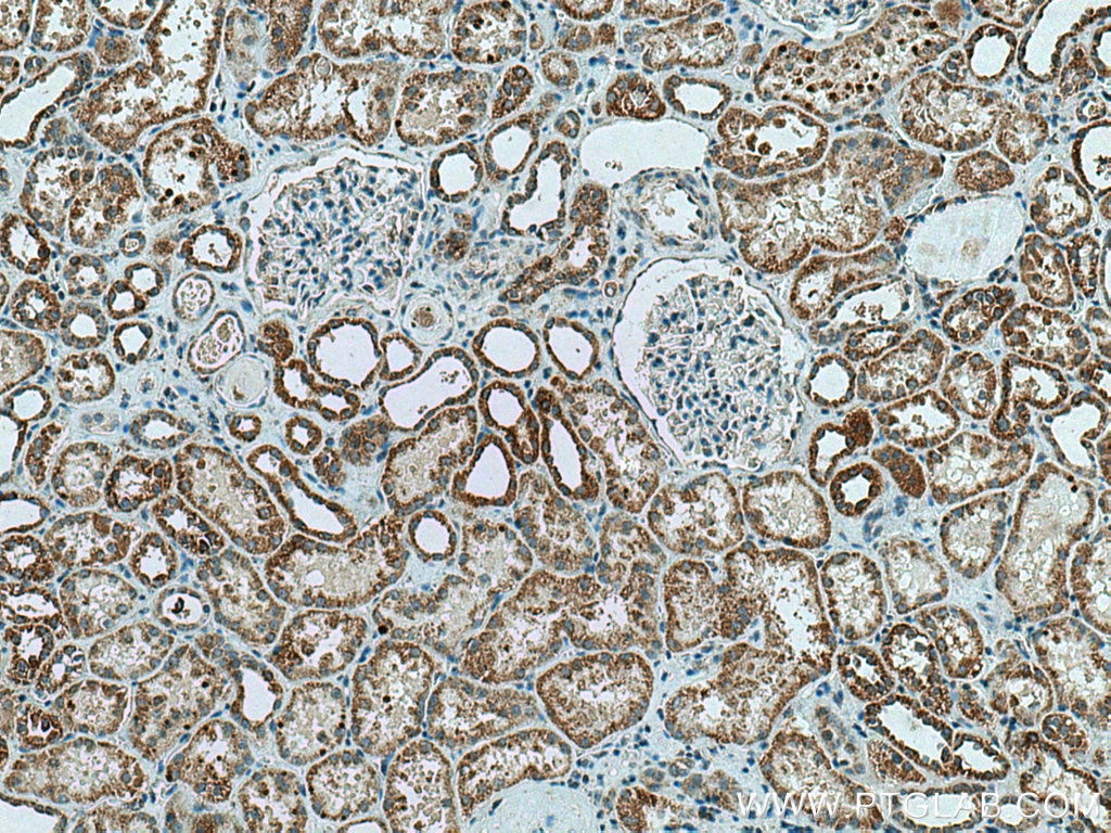Immunohistochemistry (IHC) staining of human kidney tissue using CA5B Polyclonal antibody (13342-1-AP)