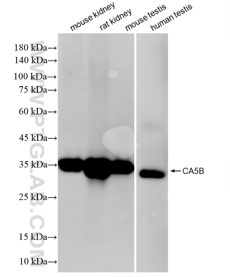 Western Blot (WB) analysis of various lysates using CA5B Recombinant monoclonal antibody (86996-1-RR)