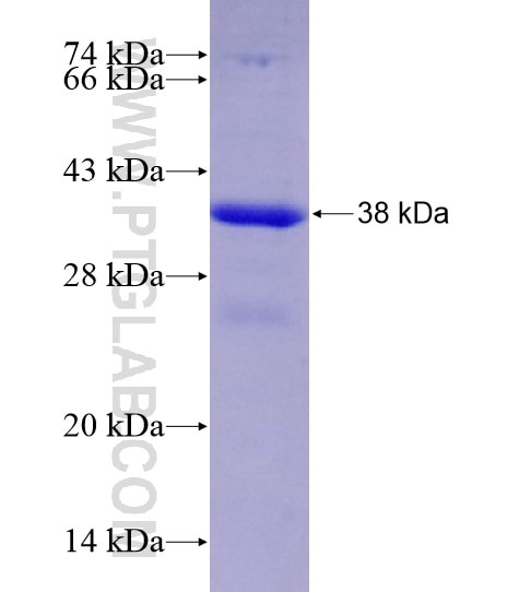 CA5B fusion protein Ag28650 SDS-PAGE