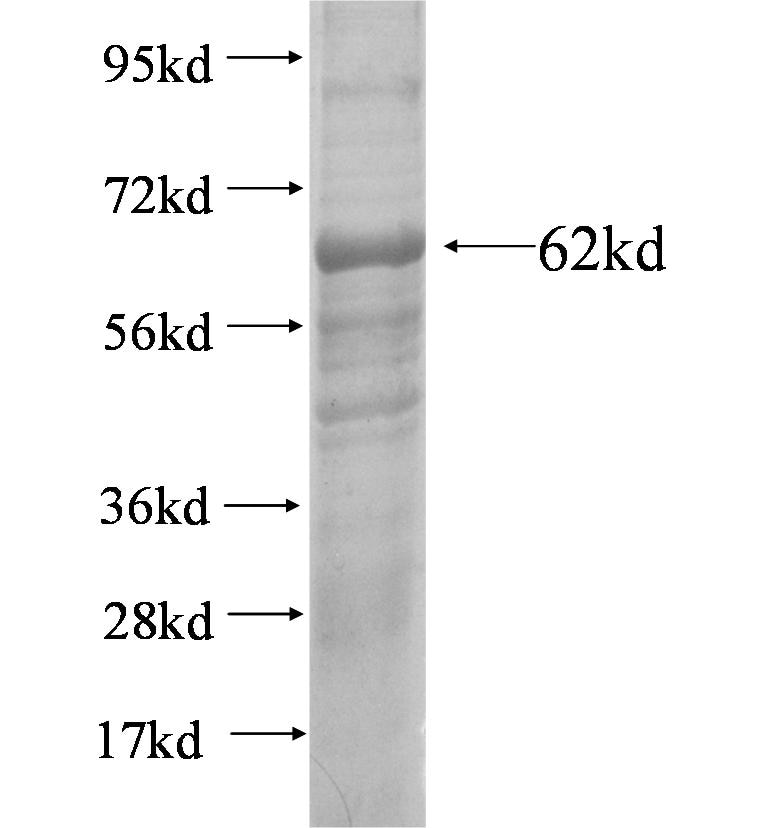 CA5B fusion protein Ag4166 SDS-PAGE
