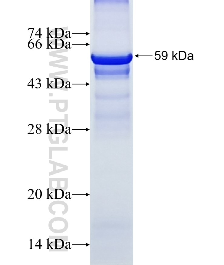 CA5B fusion protein Ag4166 SDS-PAGE