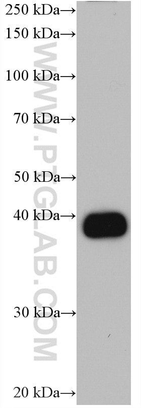 WB analysis of human saliva using 66909-1-Ig