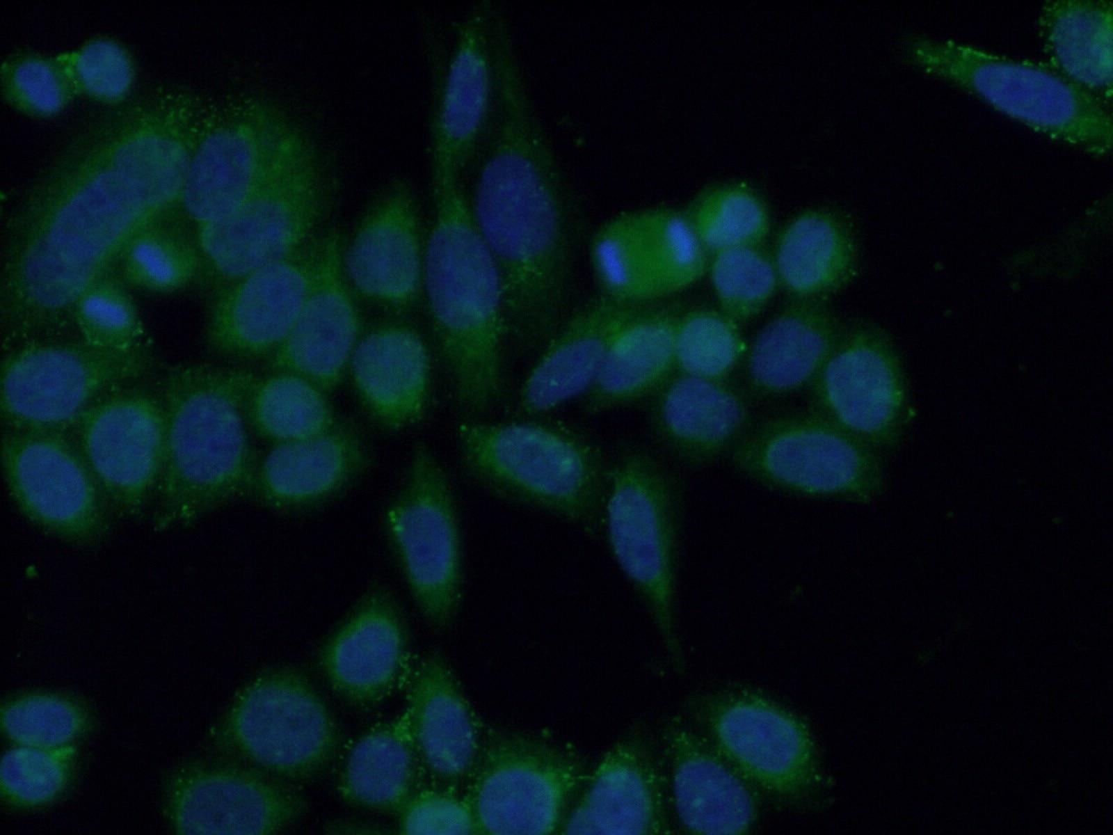 Immunofluorescence (IF) / fluorescent staining of HeLa cells using CA7 Polyclonal antibody (13670-1-AP)