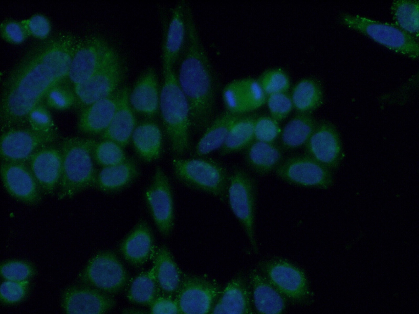 IF Staining of HeLa using 13670-1-AP