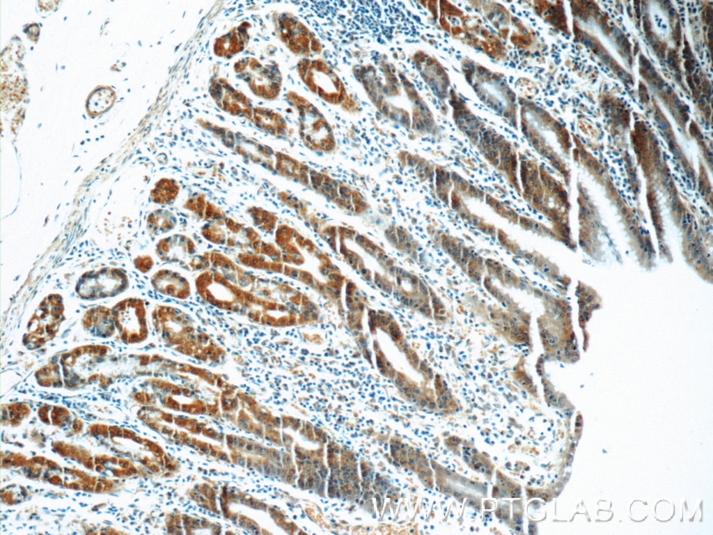 Immunohistochemistry (IHC) staining of human stomach tissue using CA7 Polyclonal antibody (13670-1-AP)