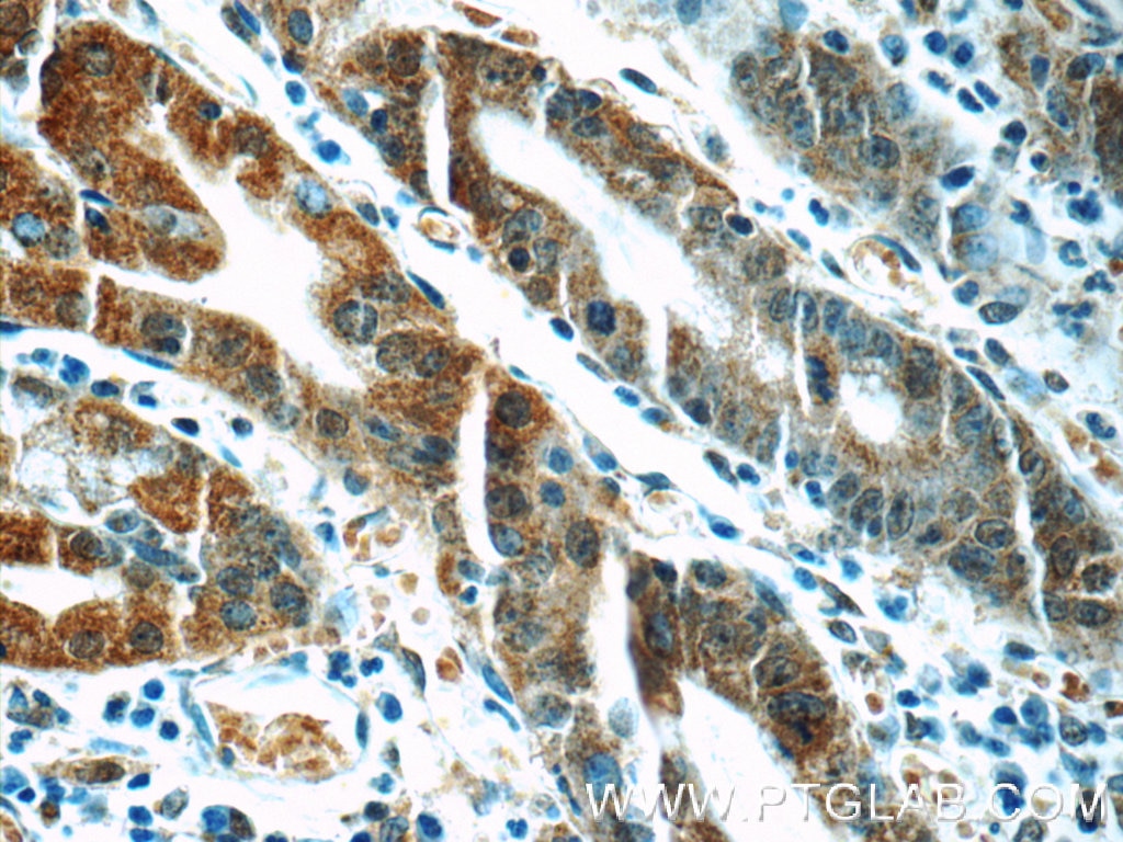 Immunohistochemistry (IHC) staining of human stomach tissue using CA7 Polyclonal antibody (13670-1-AP)