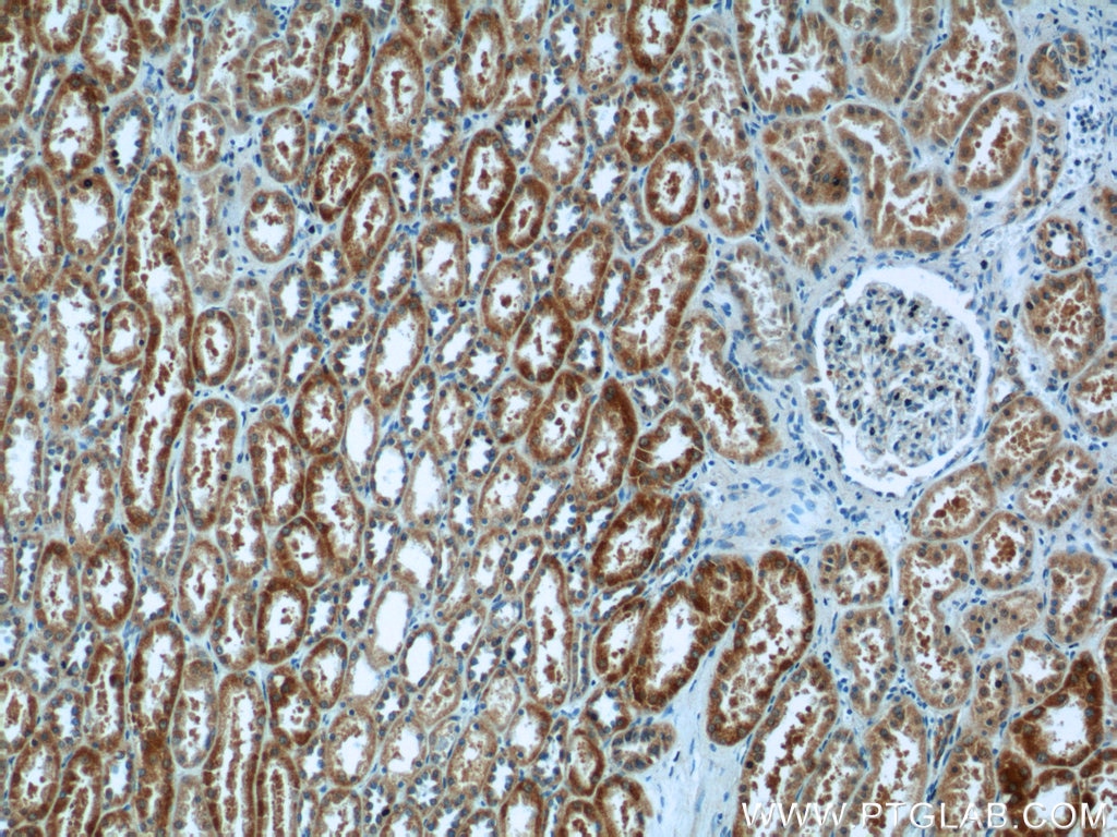 Immunohistochemistry (IHC) staining of human kidney tissue using CA7 Polyclonal antibody (13670-1-AP)