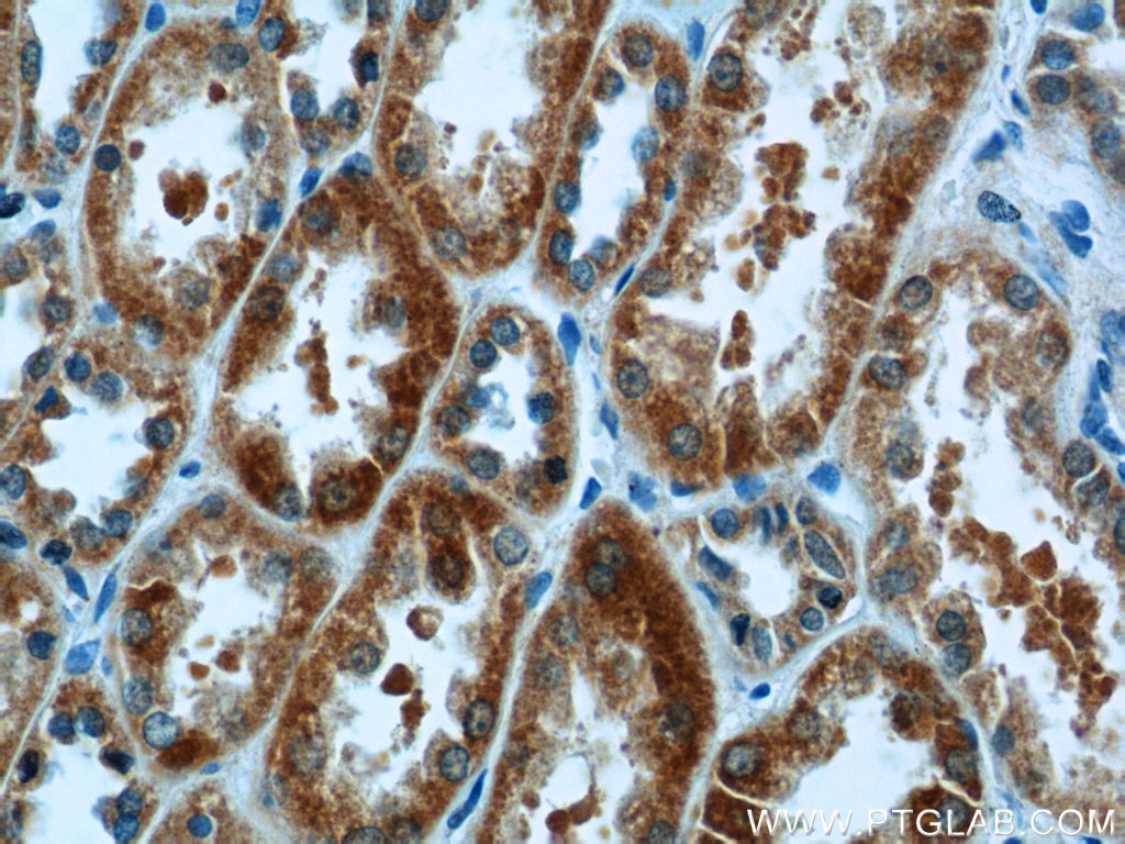 Immunohistochemistry (IHC) staining of human kidney tissue using CA7 Polyclonal antibody (13670-1-AP)