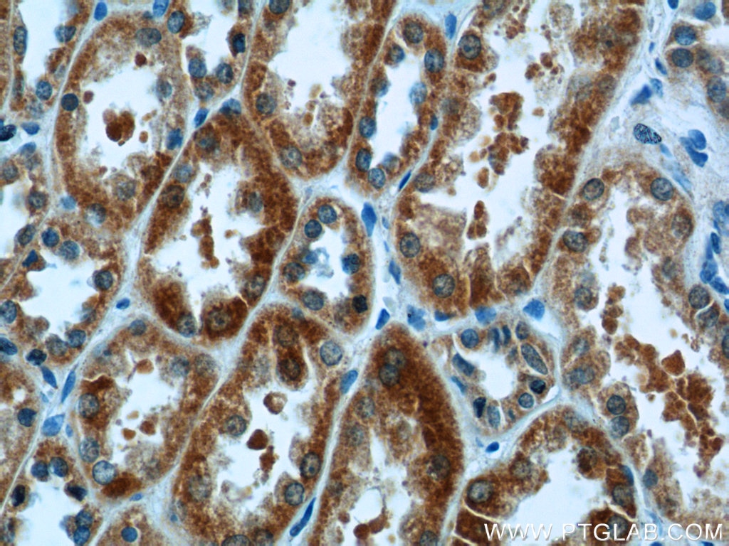 IHC staining of human kidney using 13670-1-AP