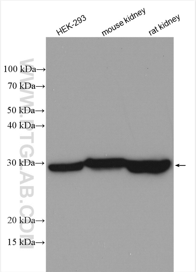 Western Blot (WB) analysis of various lysates using CA7 Polyclonal antibody (13670-1-AP)