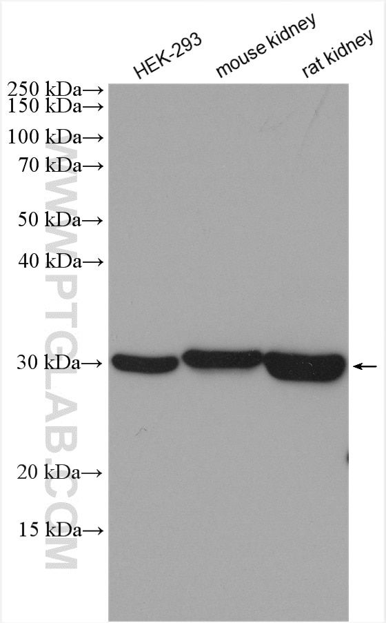 Western Blot (WB) analysis of various lysates using CA7 Polyclonal antibody (13670-1-AP)