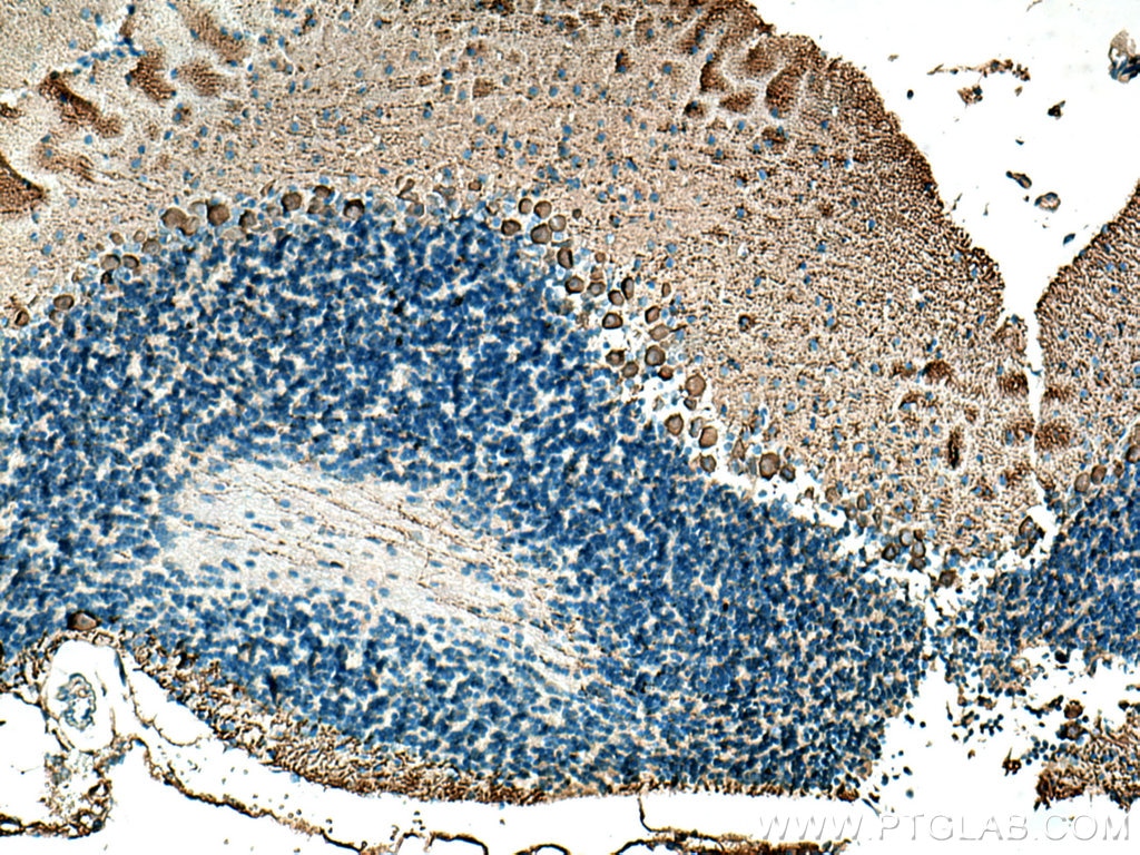 Immunohistochemistry (IHC) staining of mouse cerebellum tissue using CA8 Polyclonal antibody (12391-1-AP)