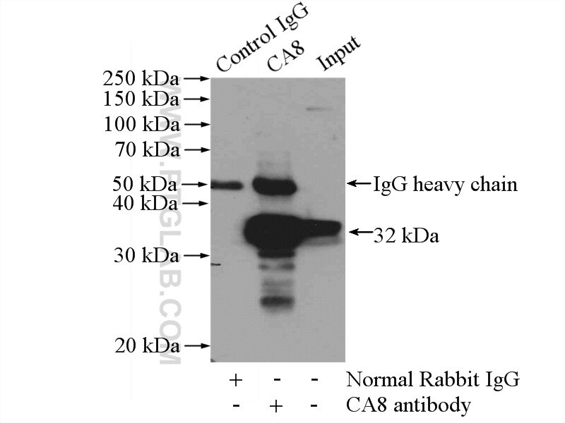 IP experiment of mouse brain using 12391-1-AP