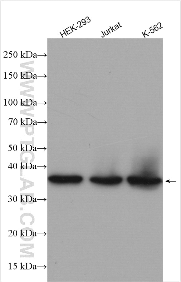 Western Blot (WB) analysis of various lysates using CA8 Polyclonal antibody (12391-1-AP)