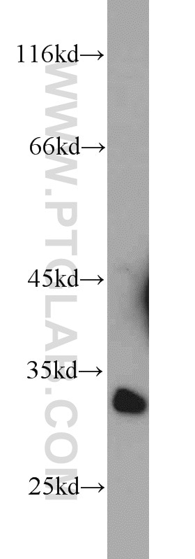 Western Blot (WB) analysis of mouse brain tissue using CA8 Polyclonal antibody (12391-1-AP)